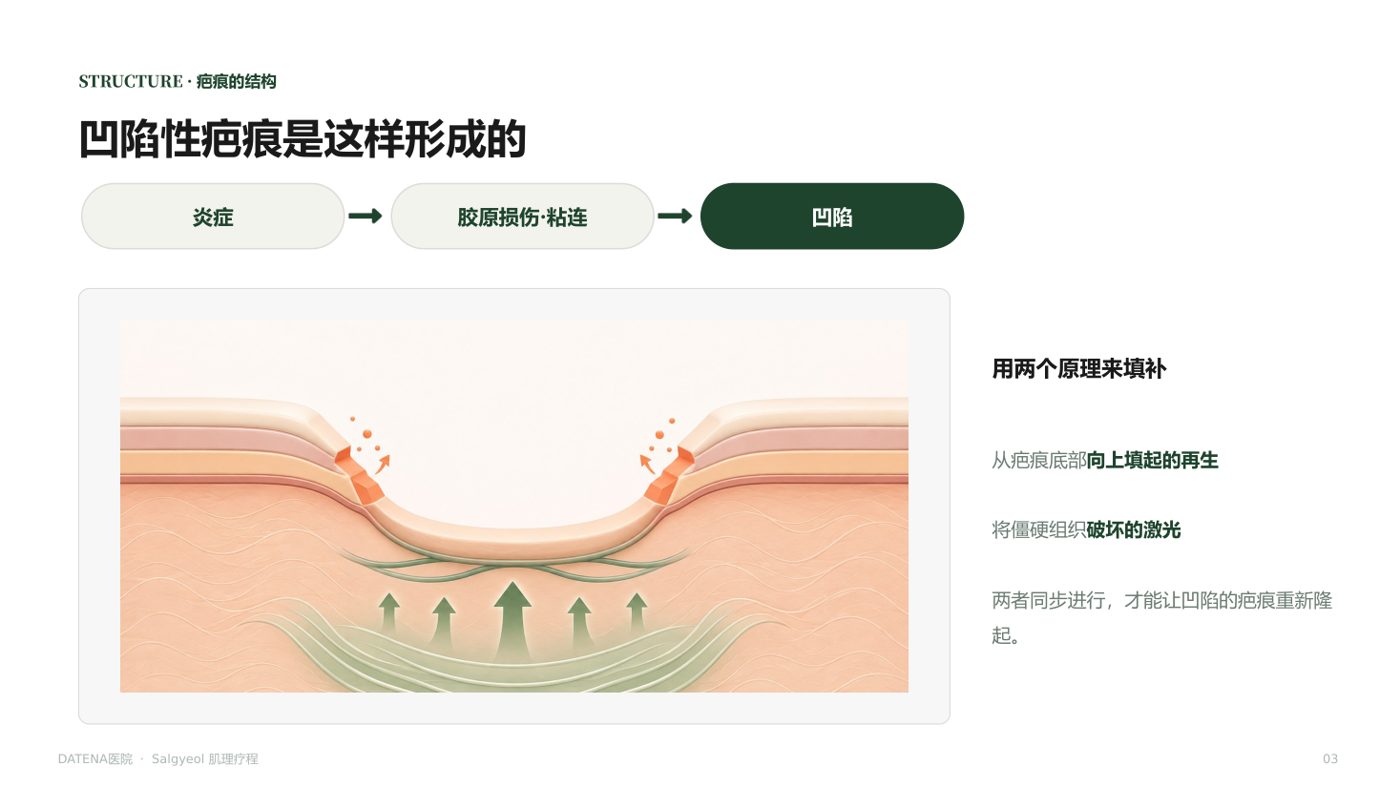 痘坑治疗项目说明资料 3/14