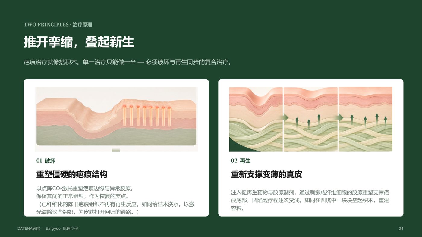 痘坑治疗项目说明资料 4/14