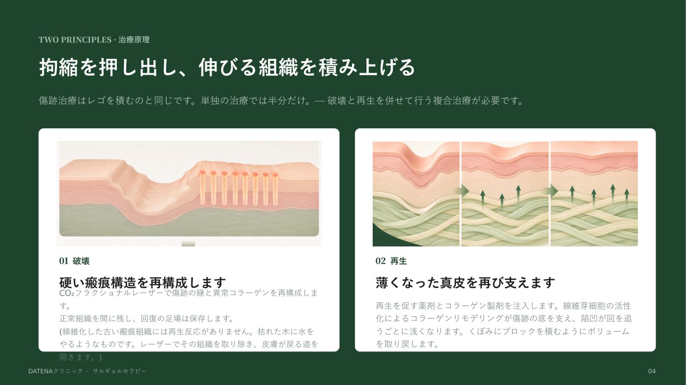 ニキビ跡治療プログラム説明資料 4/14
