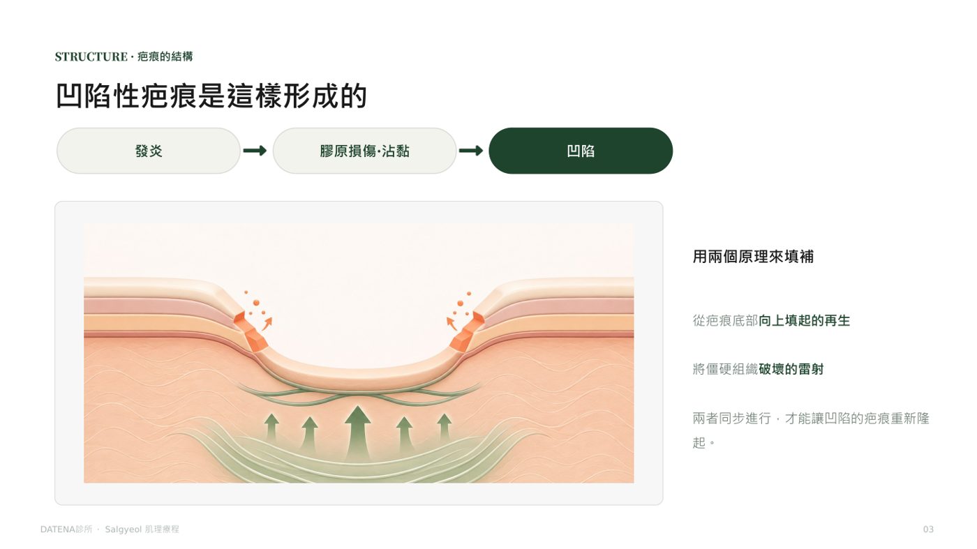 痘疤治療項目說明資料 3/14