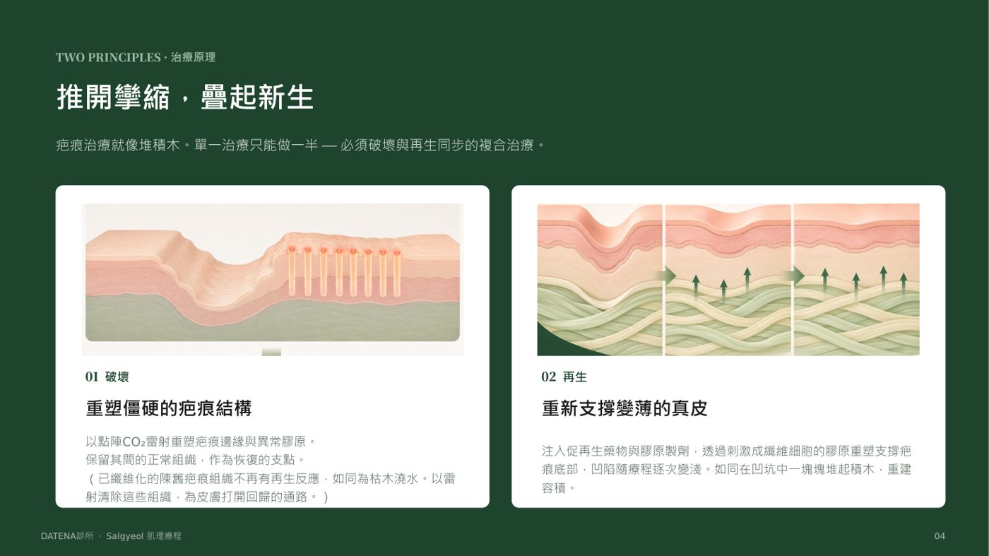 痘疤治療項目說明資料 4/14