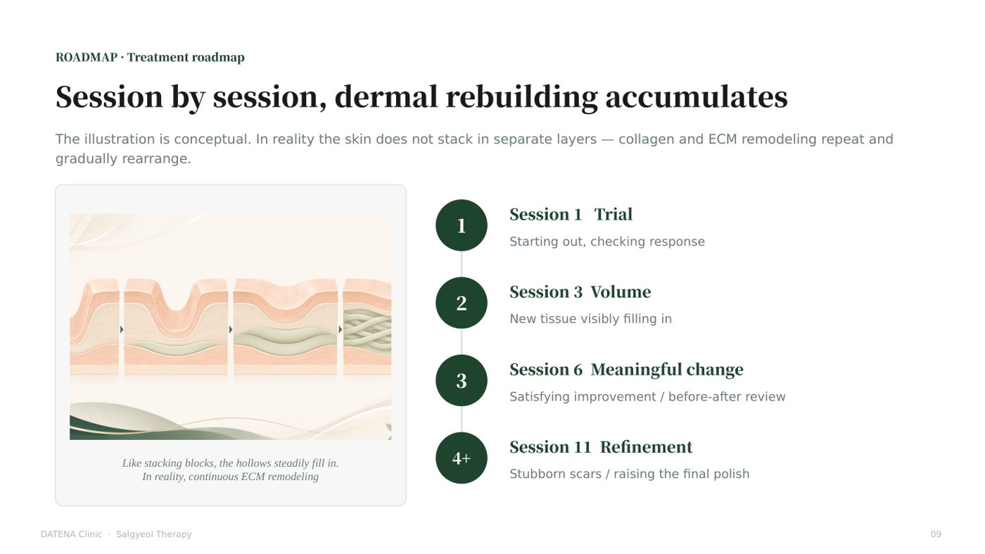 Session by session, dermal rebuilding accumulates — treatment roadmap from trial to refinement